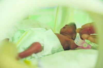 产妇6分钟内剖宫产下2男2女四胞胎(组图)
